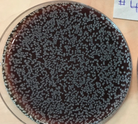 Petrischaal met bacteriën vóór behandeling